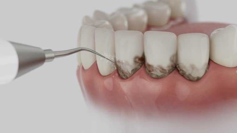 Reliable Dental contractor in Marshfield, MO by Smile Center Dentistry